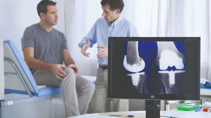 Artroplasti Nedir? Türleri Nelerdir?