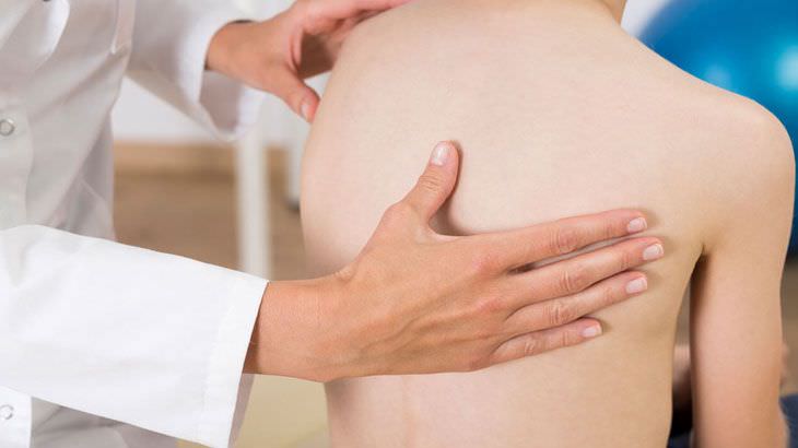 Skolyoz nedir? Skolyoz tedavi edilir mi?