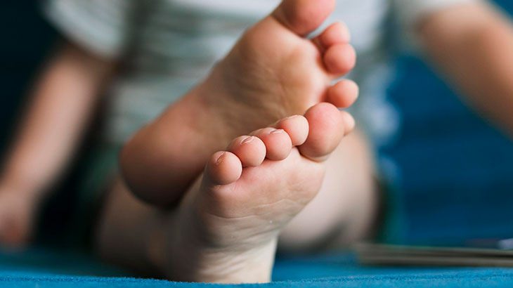 Çocuklarda Düz Tabanlık Nedir? Neden Olur? Nasıl Tedavi Edilir?