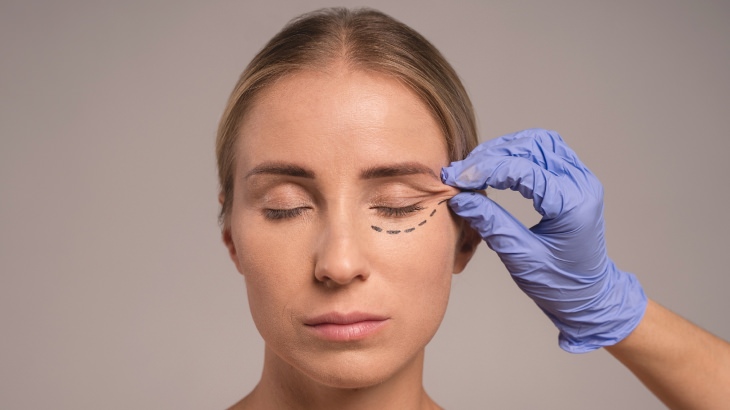 Alt Göz Kapağı Estetiği Nedir? Göz Kapağı Estetiği Nasıl Yapılır?